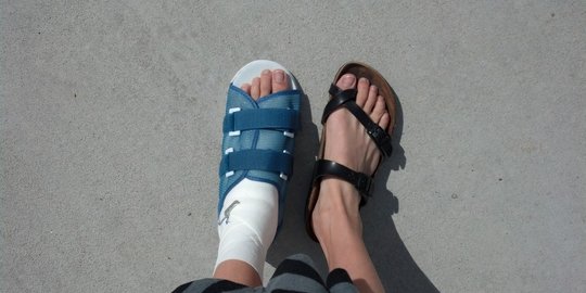 tumit terasa sakit saat berjalan? waspadai 5 penyakit ini