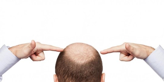 hari menikah istri gugat cerai lantaran suami botak rev4