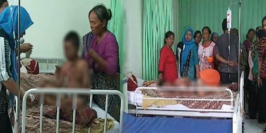 Diduga salah minum obat, kulit Deri mengelupas