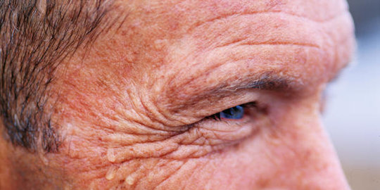 6 penyebab tak wajar muncul rasa gatal di pantat