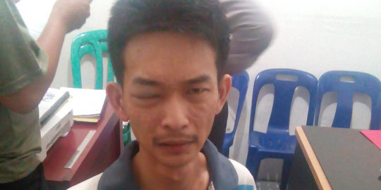 Kondisi bayi kembar yang dianiaya ayahnya terus membaik