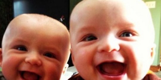 kembar ini lahir dari dua ayah berbeda rev2