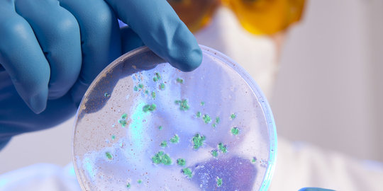 Kenali Ciliata, Protozoa yang punya rambut getar