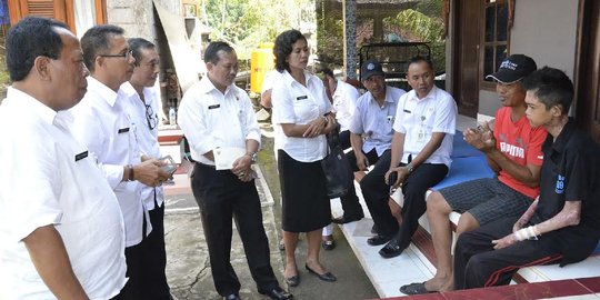 Sekian lama idap kelainan kulit, Wayan baru dikunjungi Pemprov Bali