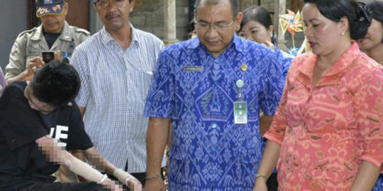 Dikunjungi istri Bupati Badung, Wayan dijanjikan akan diobati