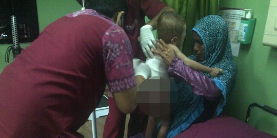 Punggung balita Nuriz melepuh, kalau tidur beralas pelepah pisang