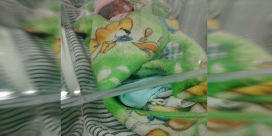 Bayi di Denpasar lahir tanpa anus, sesak napas dan hidung berlendir