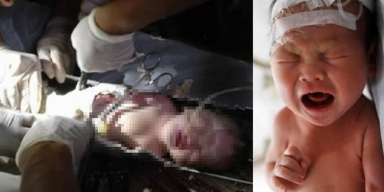 14 jam dalam mobil karena kecelakaan berhasil selamat rev1