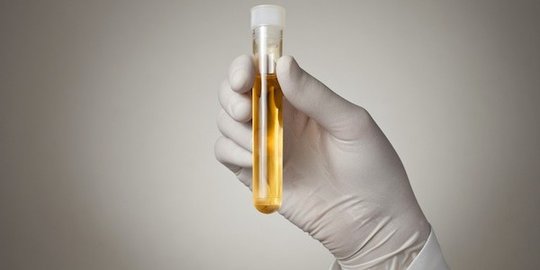 BNN tes urine anggota DPRD Bali, satu positif narkoba