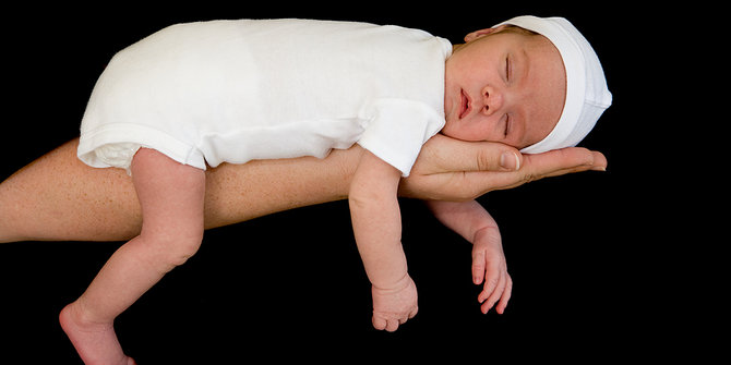 Bayi yang lahir prematur rentan terkena osteoporosis saat dewasa?