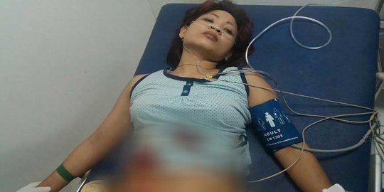 Pergoki maling di kontrakannya, wanita ini tertembak perutnya
