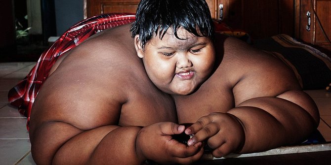 Berbobot Kilogram Ini Anak Paling Gemuk Sedunia Dari Indonesia Berbobot Kilogram Ini Anak Paling Gemuk Sedunia Dari Indonesia