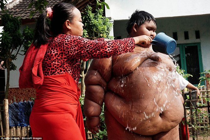 Berbobot 192 kilogram ini anak paling  gemuk  sedunia dari 