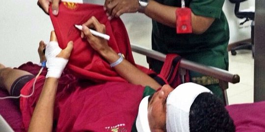 Lagi liburan di Bali, pemain MU disengat ubur-ubur