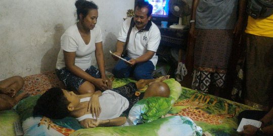 Wagub Bali kirim utusan lihat kondisi remaja penderita tumor tulang