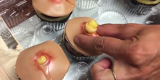 Cupcake bentuk jerawat siap pencet, kreatif atau bikin jijik?