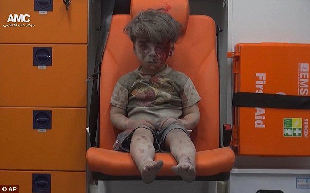 omran daqneesh