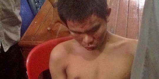 Bahan perakit bom ditemukan di indekos pelaku teror Gereja St Yosep