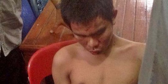 Polisi masih dalami pemberi perintah teror di Gereja St Yosep