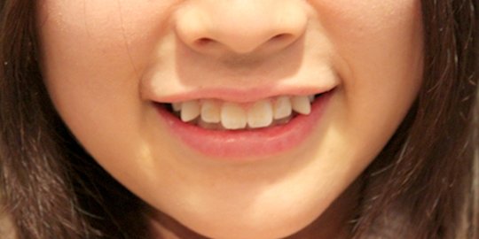 7 tradisi aneh yang dilakukan wanita agar cantik dari seluruh dunia