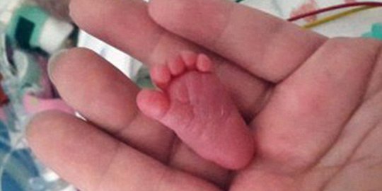 Bayi paling mungil sedunia lahir di Jerman