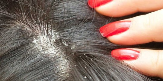 ini yang terjadi jika kamu tidur saat rambut masih basah!