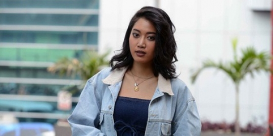 Bukan operasi plastik, Widy Vierratale tanam benang di hidung