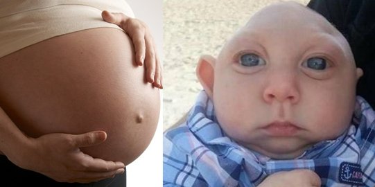 Ganasnya virus Zika mampu bikin bayi jadi tuli?