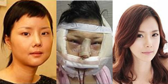 disangka penipu saat pulkam rumkit korsel beri sertifikat oplas bagi pasien rev8