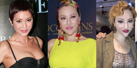 maniak oplas menderita bdd rev7