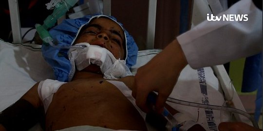 Bocah Suriah tewas usai mengira sebuah bom adalah bola mainan