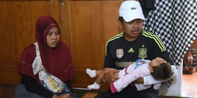 Bupati Purwakarta bantu bayi penderita mikrosefalus 