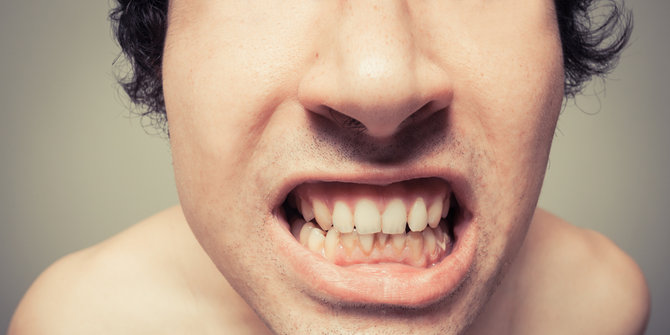 Mulut berbakteri jadi penyebab kamu sering pusing