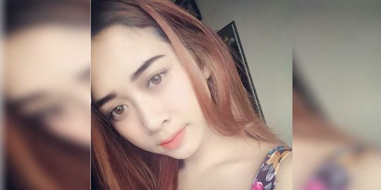 Polisi terus buru penyiram air keras penyanyi cantik di Bandung