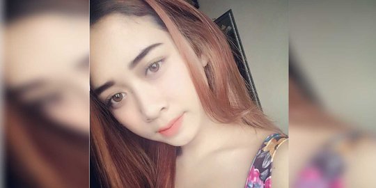 Misteri penyiram air keras ke mahasiswi cantik