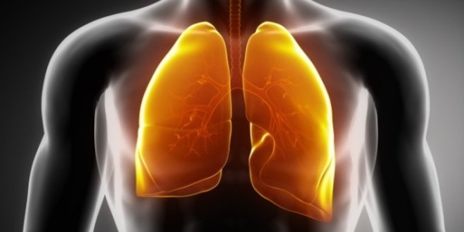 3 Alasan utama kenapa non perokok bisa terkena kanker paru-paru