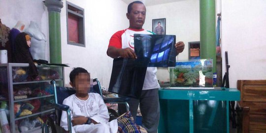 Diduga korban malapraktik, kaki bocah 12 tahun di Malang membusuk