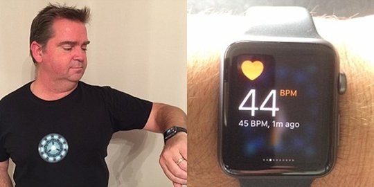 Fiuh! Dosen ini nyawanya selamat berkat arloji Apple Watch