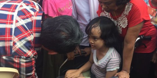 Ahok temui anak penderita hidrosefalus: Sabar ya, Tuhan sayang kamu