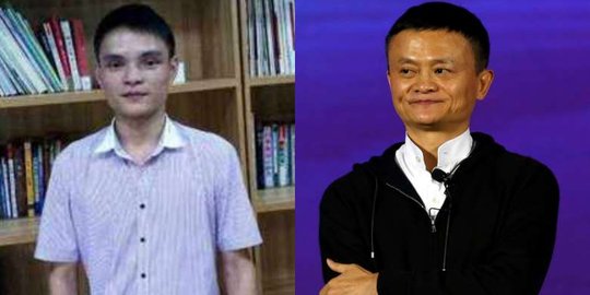 Demi mirip Jack Ma, pria ini rela rogoh kocek Rp. 1,9 M buat operasi