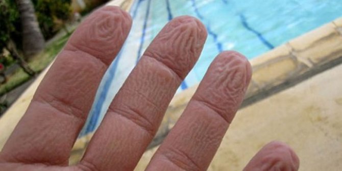 Kenapa kulit jari tangan jadi berkerut saat kena air?