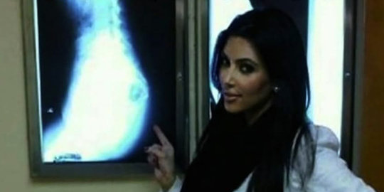 evolusi kim kardashian dalam 10 tahun terakhir, bikin geleng-geleng!