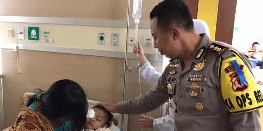 Kisah Kapolres Cimahi bantu balita penderita tumor mata