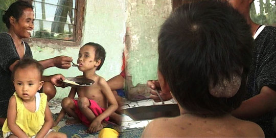 Angka gizi buruk di Aceh Barat naik 14 persen