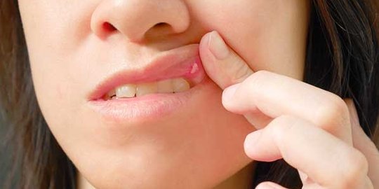 tak hanya untuk kecantikan, ini 8 efek mengejutkan dari lidah buaya!