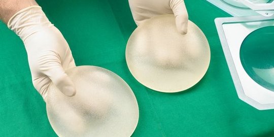 8 bahaya mengerikan dari implan payudara, sudah tahu?
