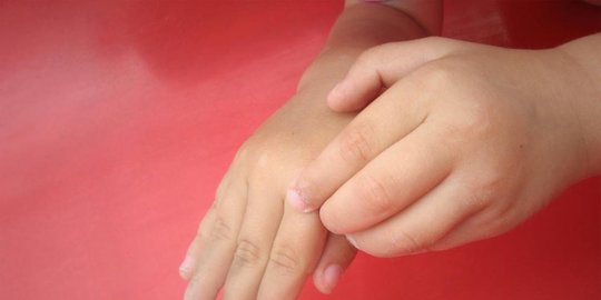 pantat sering gatal tak keruan? ternyata 9 hal ini jadi sebabnya
