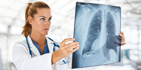 Tips jitu cegah kanker paru-paru