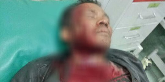 Cari pengeroyok teman, polisi dibacok warga di Kampung Bahari