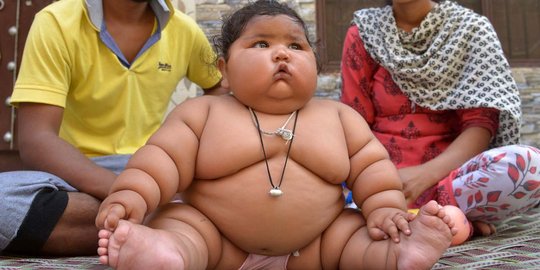 Kisah Chahat, bayi 8 bulan dengan berat 17 kg